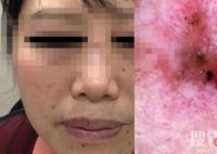 女子陪閨蜜就診自己卻被查出癌癥 檢查結果讓兩人同時大跌眼鏡