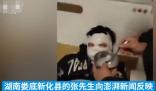 12歲男孩看短視頻學做火藥被炸傷 傷情嚴重臉被炸黑簡直太可憐了