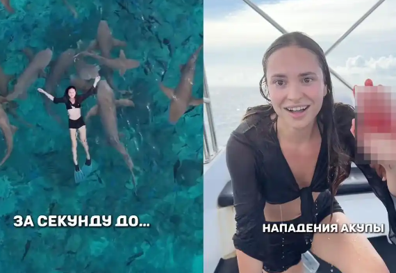 女歌手與鯊魚共游被咬傷 事件始末2025最新消息