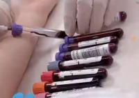 醫生:胖人比瘦人更能抗病 事件始末2025最新消息